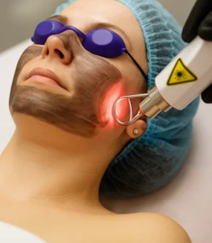 Skin Lightening Treatment