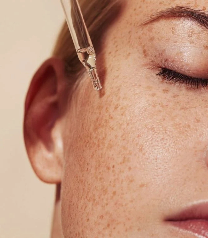 Melazma Treatment