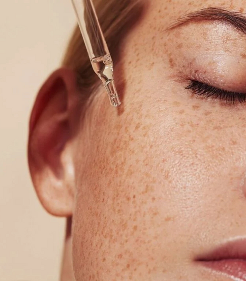 Melazma Treatment