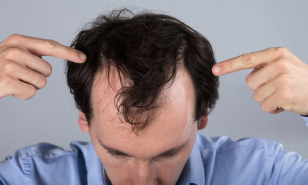 Hairfall Treatment